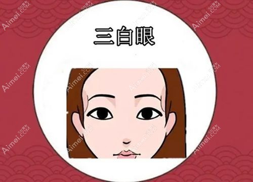 杜园园修复价目表2025:杜园园修复肉条眼5.5万+双眼皮宽变窄5万+内外切眼袋失败6万起(含面诊费)