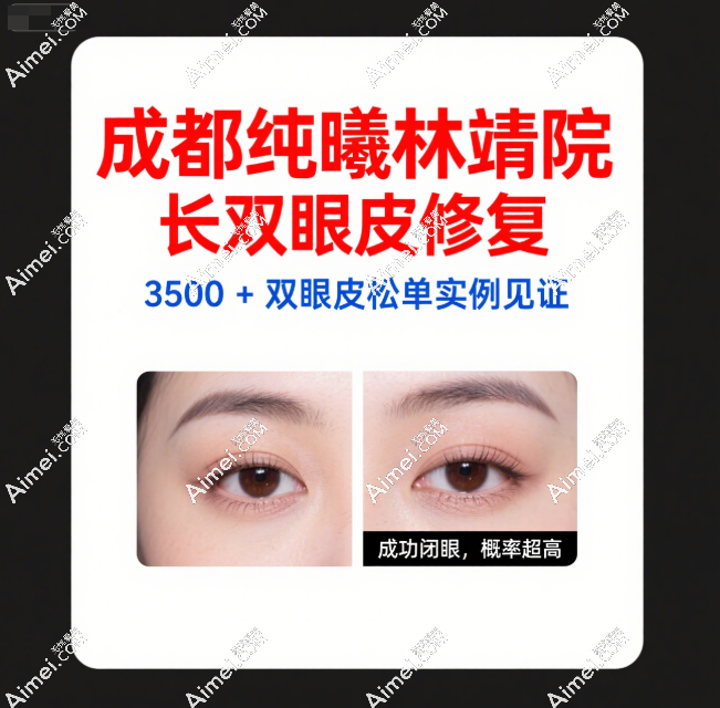 成都纯曦林靖院长双眼皮修复实例见证:3500+双眼皮松单后能闭上眼睛成功概率高!
