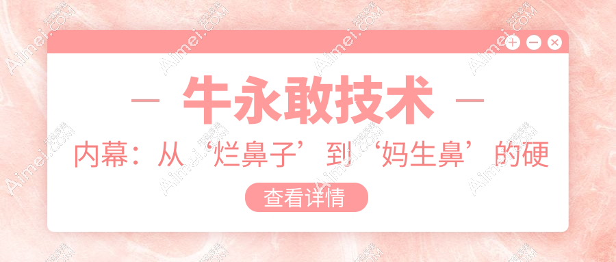 牛永敢技术内幕:从‘烂鼻子’到‘妈生鼻’的硬核武器