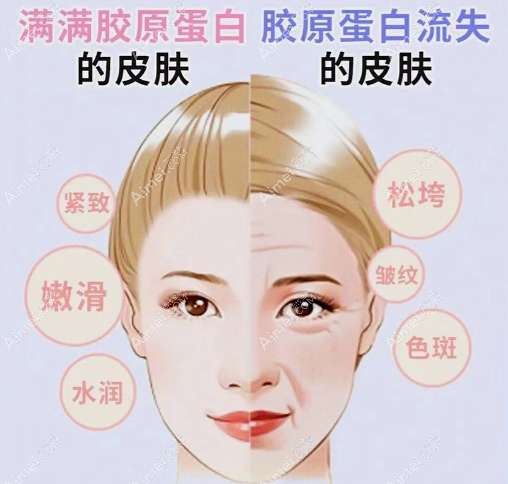 面部去皱 面部去皱