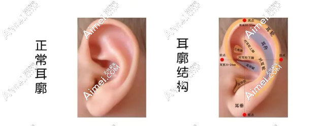 北京协和医院做耳再造术后费用 北京协和医院做耳再造术后费用