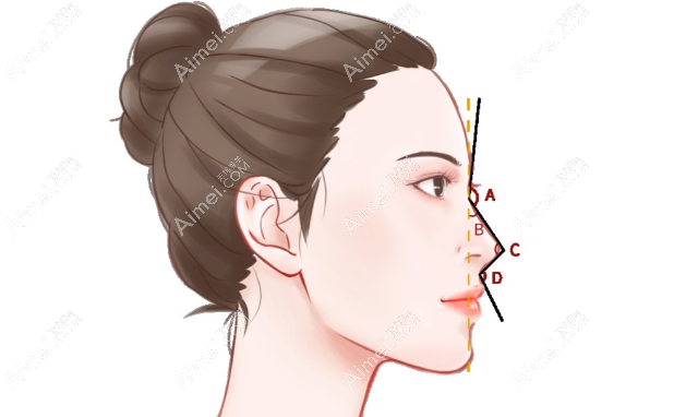 做鼻子 做鼻子
