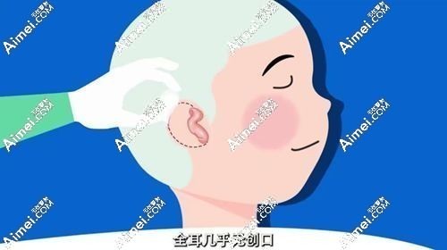 怎么才能挂上协和的号 怎么才能挂上协和的号