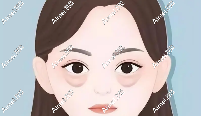 国内眼袋修复好的医生前十名单爱美网 国内眼袋修复好的医生前十名单爱美网
