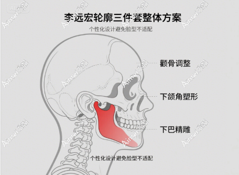 轮廓三件套 轮廓三件套