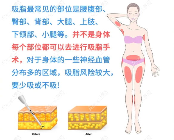 北京减肥哪个医院正规好排名榜:八大处/玉之光等10家实力口碑减肥医院推荐 北京减肥哪个医院正规好排名榜:八大处/玉之光等10家实力口碑减肥医院推荐
