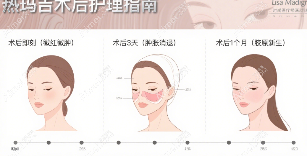避开护理 “隐形坑”:明星私教不会说的 3 个细节 避开护理 “隐形坑”:明星私教不会说的 3 个细节