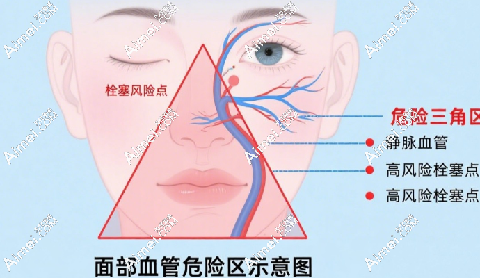 危险三角区 危险三角区
