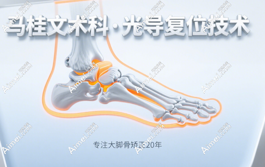 马桂文术科大脚骨手术中的光导复 马桂文术科大脚骨手术中的光导复