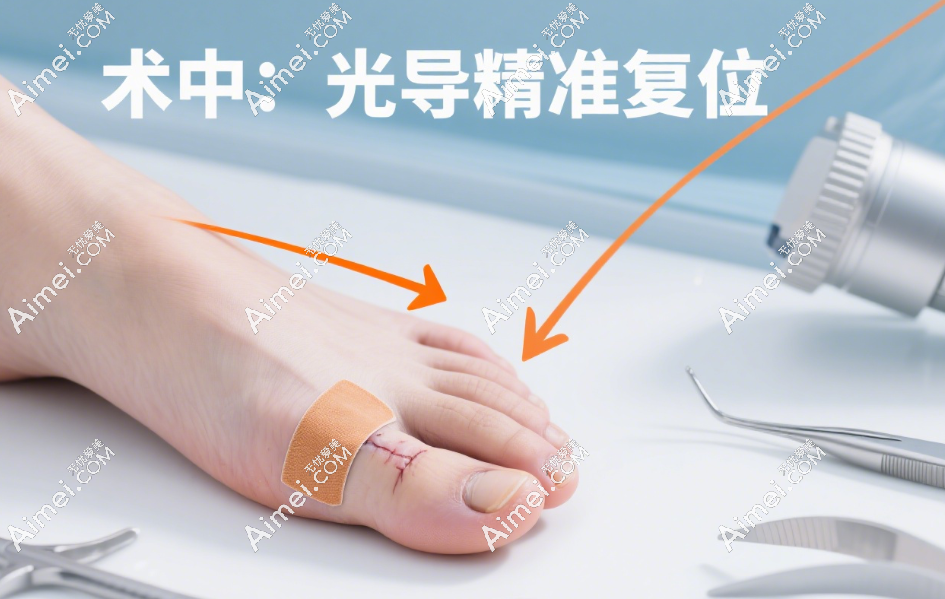 马桂文术科大脚骨手术中的快速秘诀 马桂文术科大脚骨手术中的快速秘诀