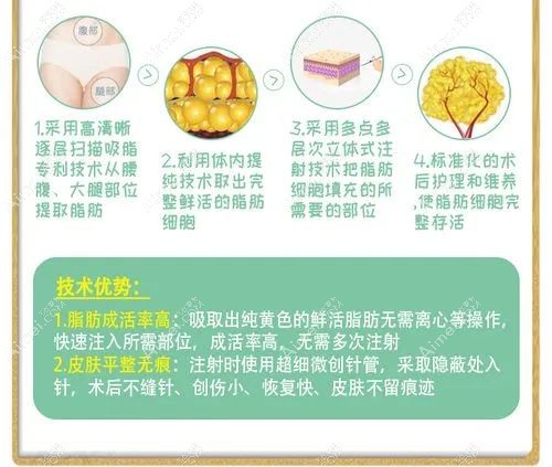 重庆脂肪丰胸出名的医院前十选择建议 重庆脂肪丰胸出名的医院前十选择建议