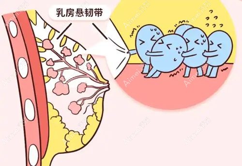 产后胸部下垂矫正多少钱 产后胸部下垂矫正多少钱