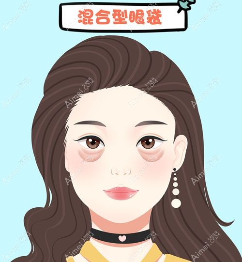 眼袋泪沟显疲惫怎么改善 眼袋泪沟显疲惫怎么改善