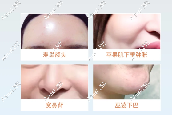 上海郭健馒化修复医生患者评价 上海郭健馒化修复医生患者评价