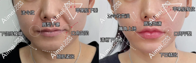 上海郭健馒化修复价格 上海郭健馒化修复价格