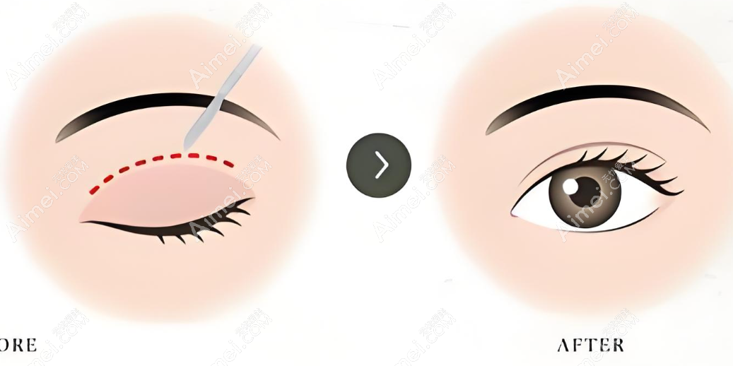 20250915659713.png 截图20240412202652.png