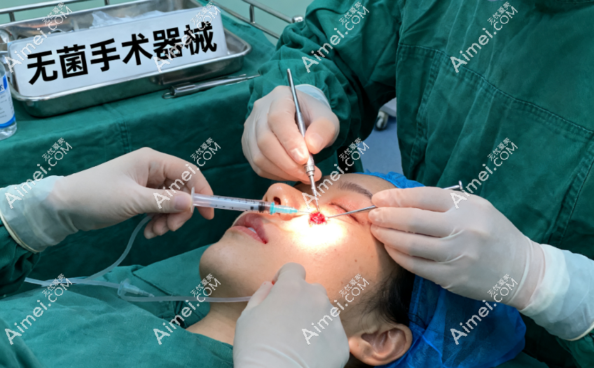 讲到底丁小邦医生取注射物实力怎么样 讲到底丁小邦医生取注射物实力怎么样