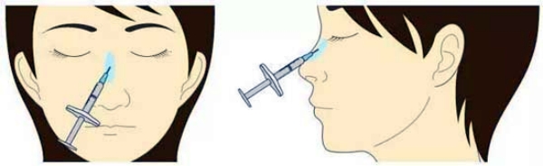广州曙光张小芸注射隆鼻价格www.dlren.com