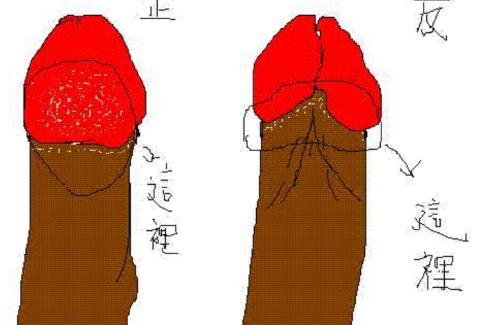 王文卫和李国君谁做增粗延长手术好www.dlren.com
