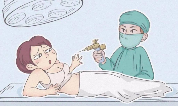 3s人鱼体雕适合人群