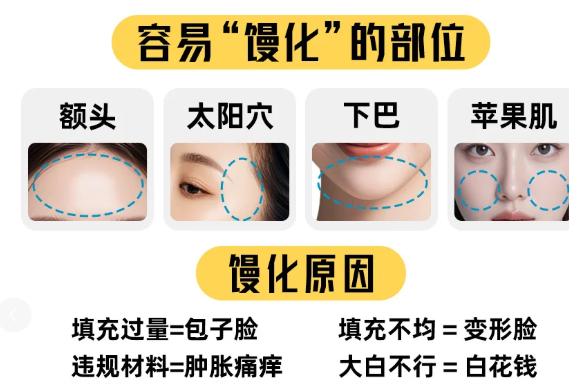 珠海新颜整形馒化脸修复超赞,院长亲诊审美在线术后自然不假面