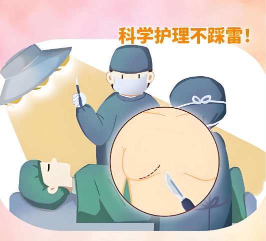 广州郝永生隆胸黑料没有?姐妹亲测没有:乳晕切口双平面技术3天变好,92%疤痕隐蔽度真实图片大公开