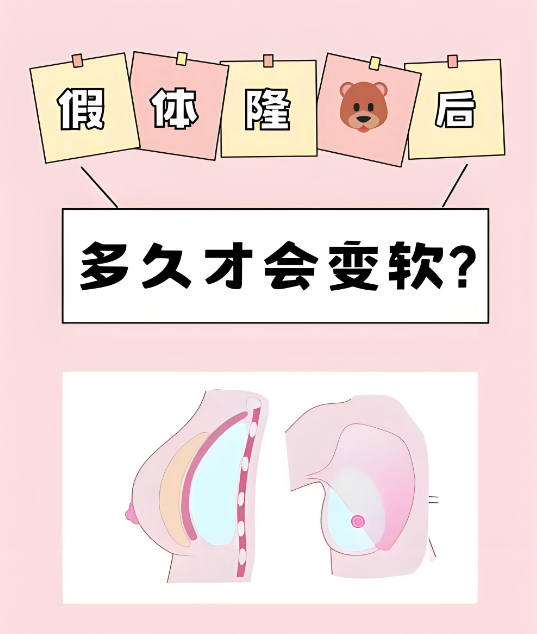 整形李高峰是专攻胸部整形吗?是的几十年临床经验靠谱,医生亲述假体与脂肪复合丰胸适合哪些人