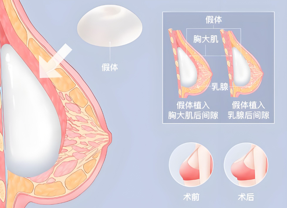 唐志荣做胸www.dlren.com