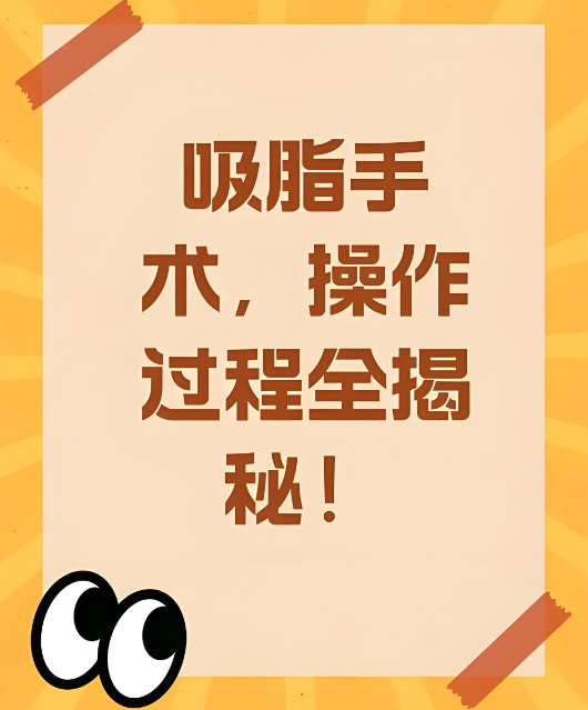 广州吸脂医生PK:邝石峰做吸脂好还是王世虎?5大维度帮你选对吸脂医生