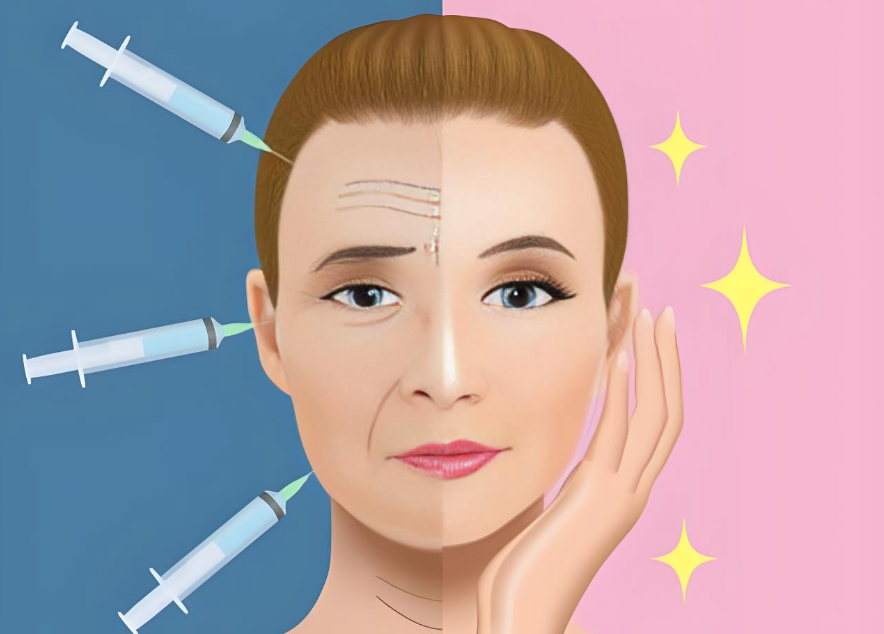 廖云君害多人毁容脂肪凹凸不平是诋毁:新解析:脂肪填充3大避坑指南+修复费用全公开