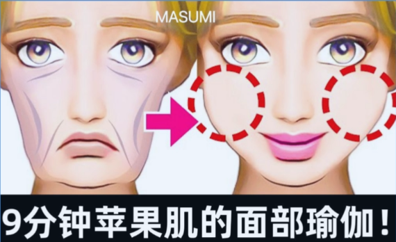 苹果肌填充