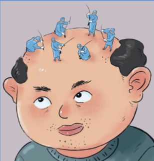 植发