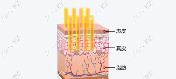 南通维多利亚李冬颖院长皮肤激光怎么样 南通维多利亚李冬颖院长皮肤激光怎么样