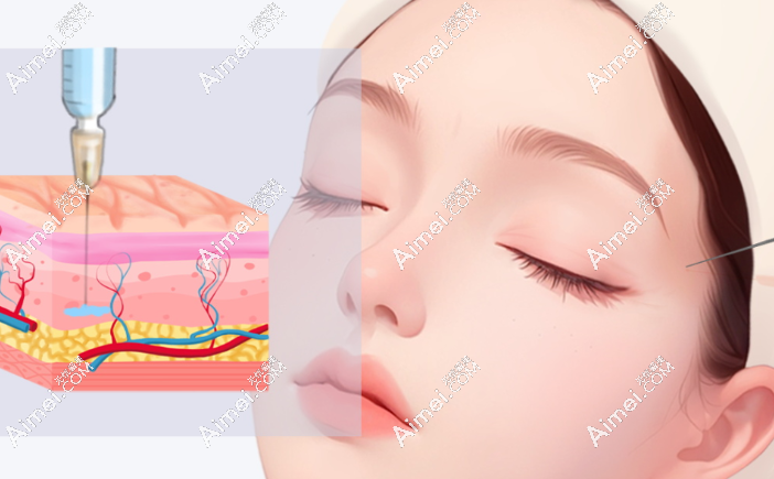 黄治平细腻的注射技巧 黄治平细腻的注射技巧