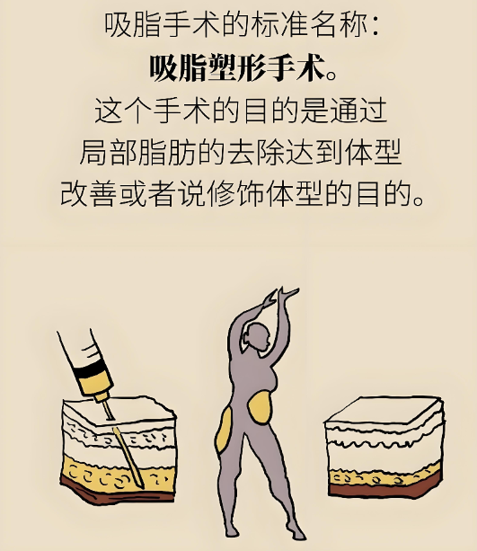 广州郭震宇吸脂怎么样