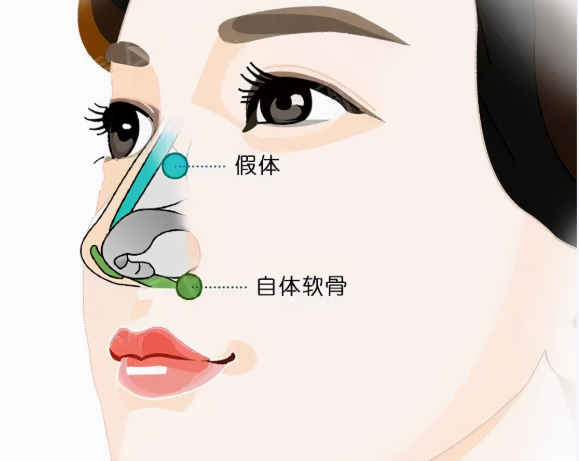 省钱攻略