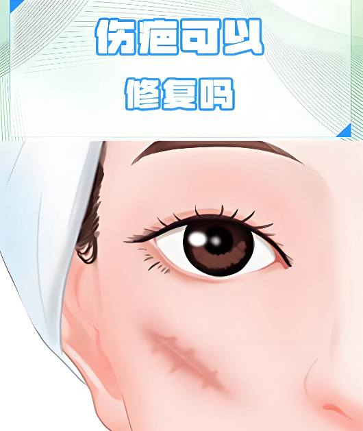 兰州维多丽亚祛疤 兰州维多丽亚祛疤