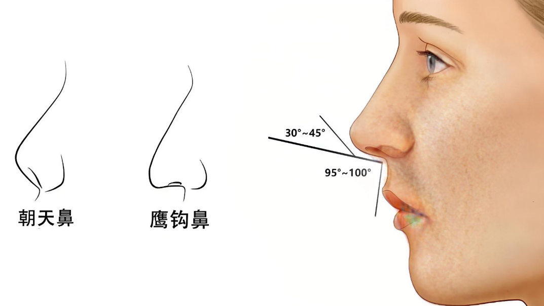 广州高顺福修复鼻子www.dlren.com