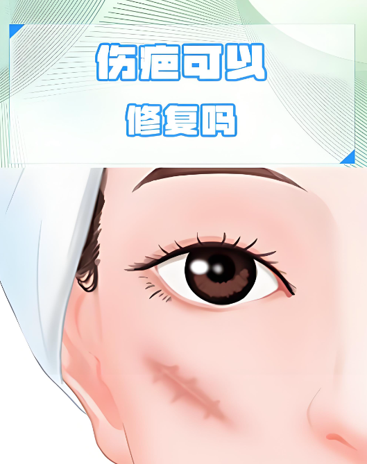 广州曙光疤痕修复靠不靠谱?我脸上这道疤被他们治得几乎看不见了,来上传一组无滤镜对比图