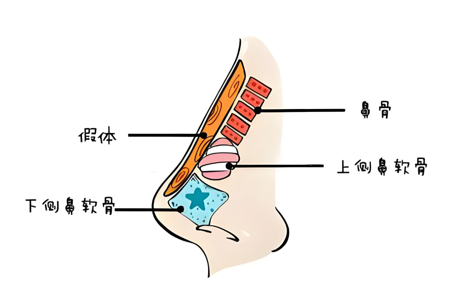 东莞鼻综合推荐医院排行榜www.dlren.com