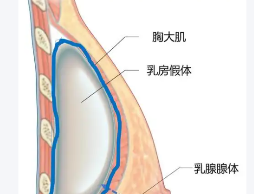 曲靖华美美莱整形美容丰胸如何?价格与消费:透明合理,避免套路