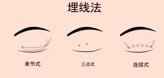曲靖华美美莱吴双医生注射顾客隐私