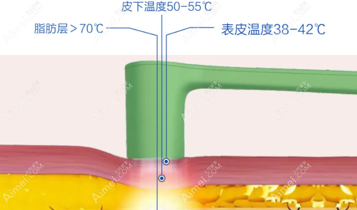  双下巴体雕