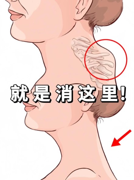 黄学锋消除富贵包是真的有效