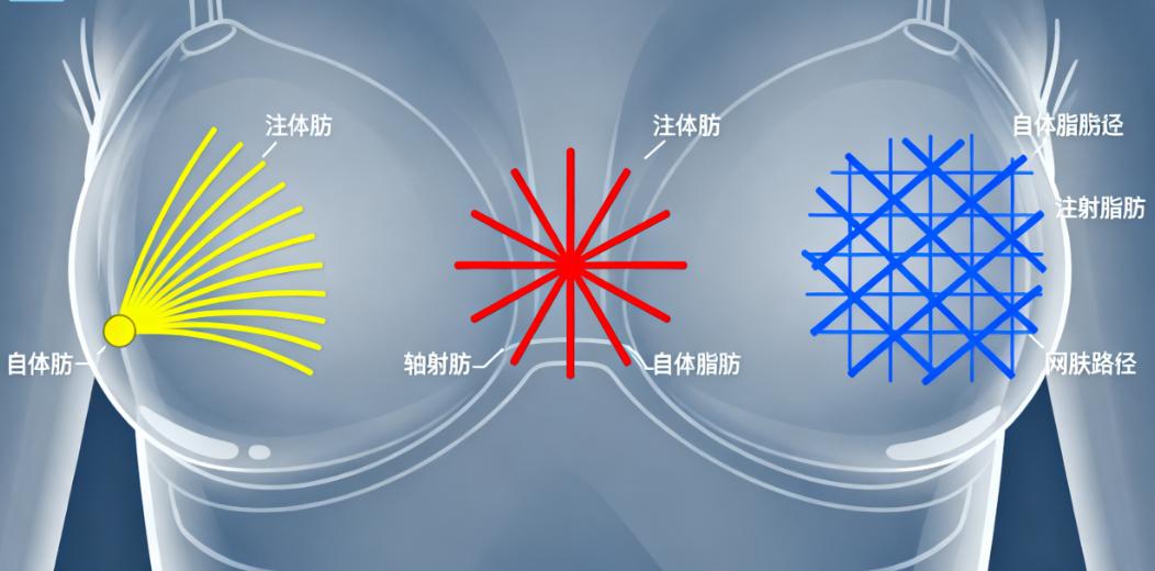 万连壮栗勇隆胸效果对比