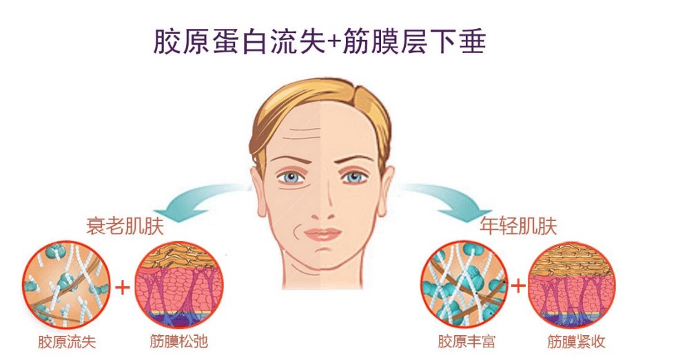 魏广运vs杜太超拉皮哪个好