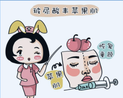 玻尿酸填充