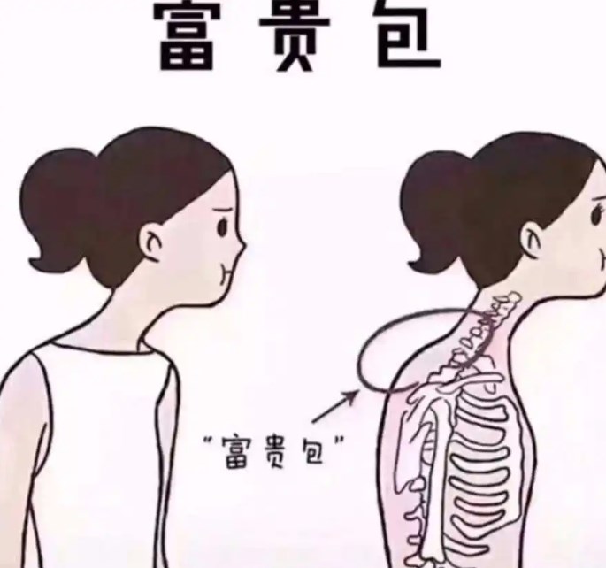 成都友谊医院治疗富贵包的预约及服务体验