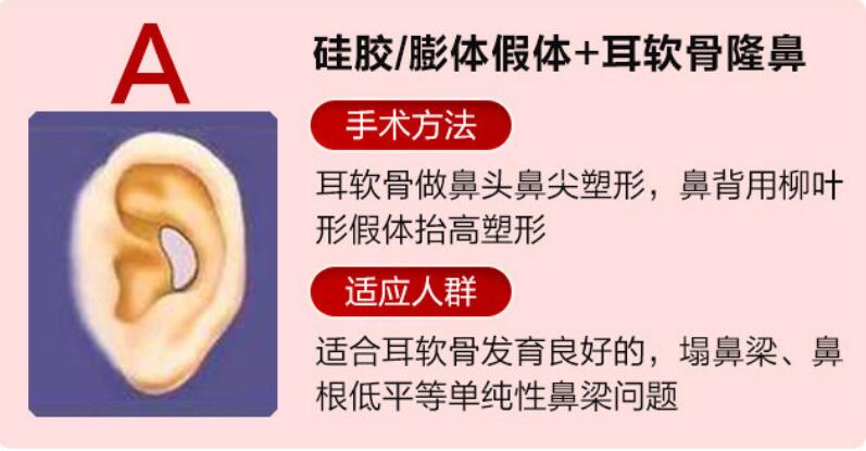 深圳非凡整形梅够明医生做鼻子口碑真实吗?多位求美者术后分享,风格自然而且不会过度