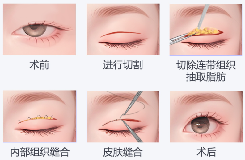 北京李燕医生怎么预约